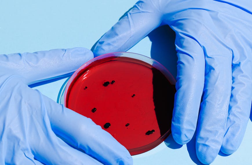 Person Holding Petri Dish